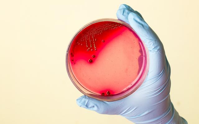 Een hand houdt een petrischaaltje vast.