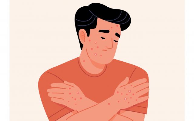 Illustratie van een somber persoon met de armen kruislings over elkaar. Op de armen en het gezicht zitten ronde vlekken.