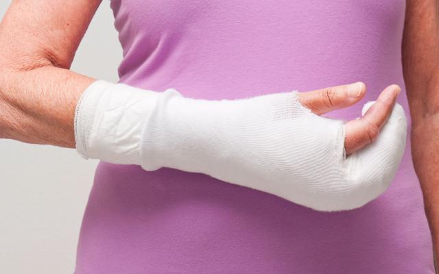 Een arm in het gips.