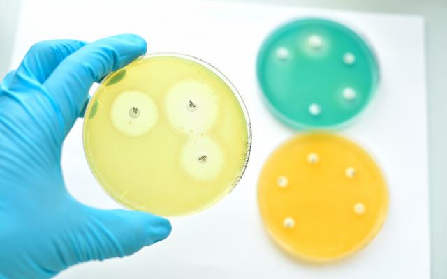 Drie petrischaaltjes.