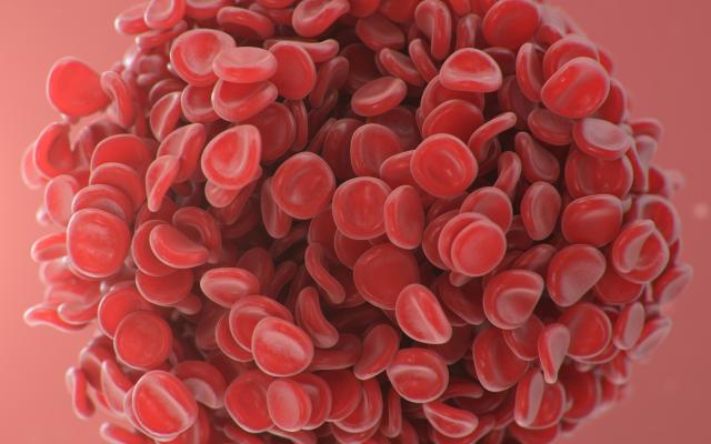 Foto van een microscopische embolie