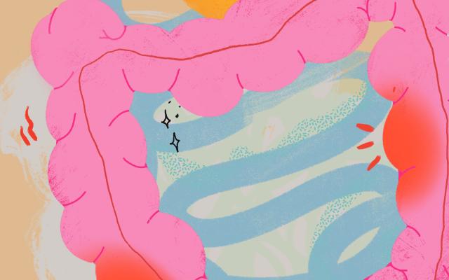 Illustratie van een ontstoken darm