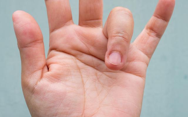 Een hand waarvan de ringvinger gebogen is