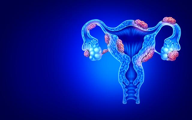 Illustratie van vrouwelijke geslachtsorganen me gezwellen erop