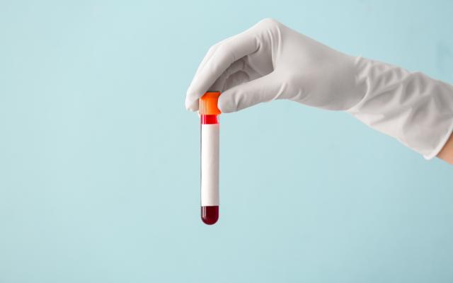 Iemand die een reageerbuis met bloed vasthoudt