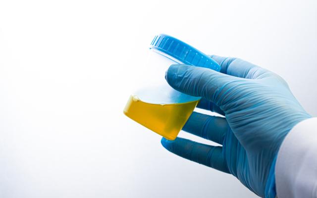 Een gehandschoende hand die een potje urine vasthoudt