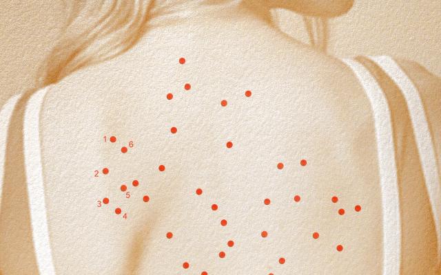 Een rug met uitslag erop