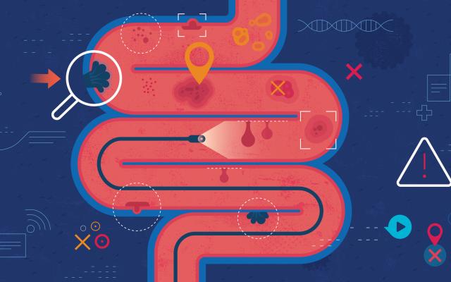 Illustratie van darmen