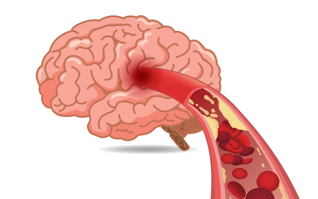 Illustratie van de binnenkant van een ader met propjes erin