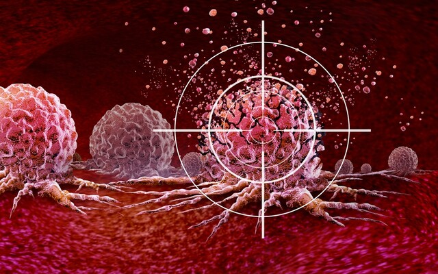 Tumor met een vizier erop gericht