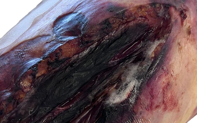 Wond met pluisjes erin