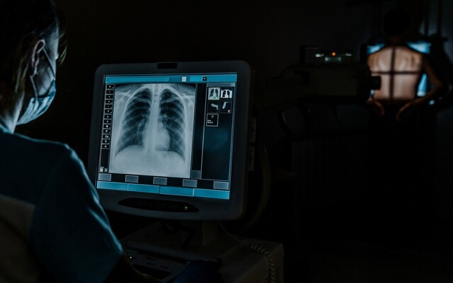 arts kijkt naar scherm van CT-scan