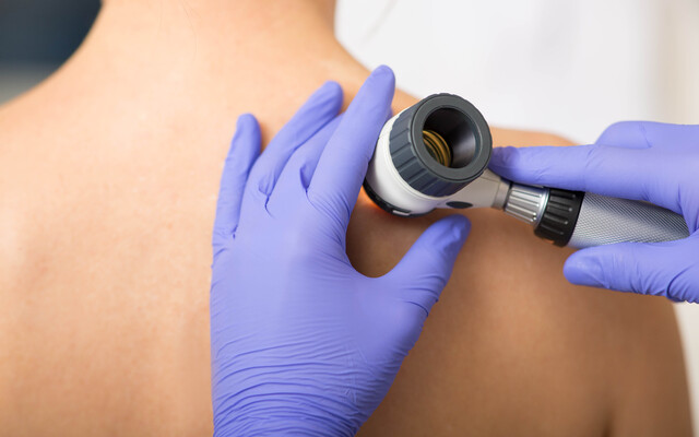 Iemand die een huidonderzoek krijgt