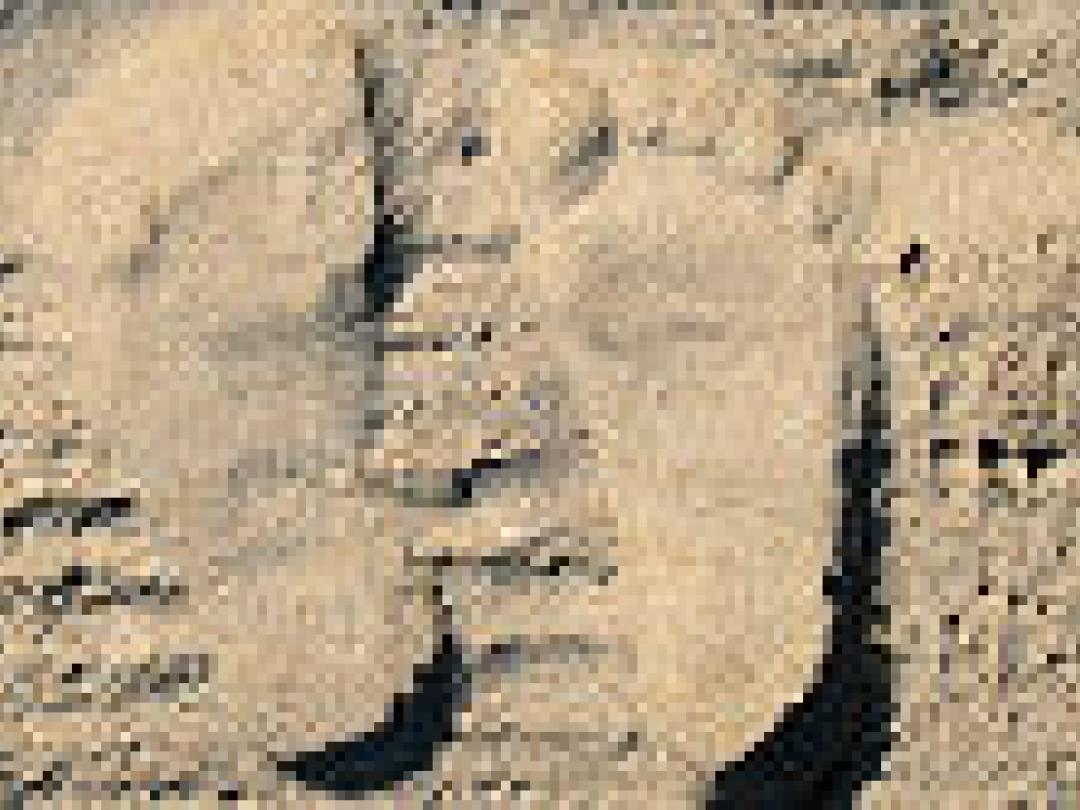 Steunzool met laterale wig geeft geen verlichting bij knieartrose