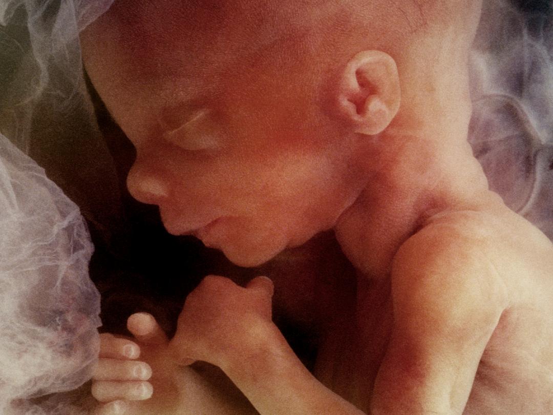 Een foetus.