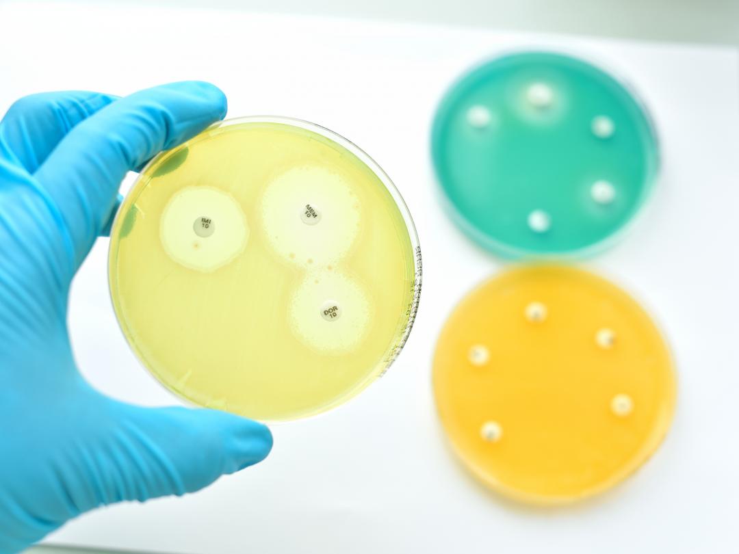 Drie petrischaaltjes.