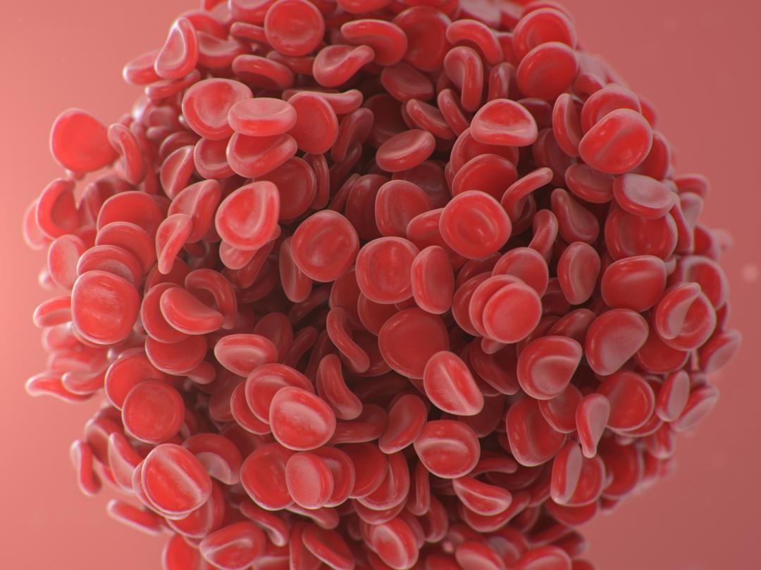 Foto van een microscopische embolie