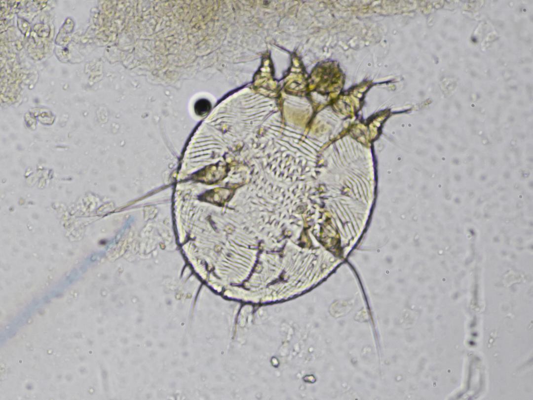 Illustratie van scabiës