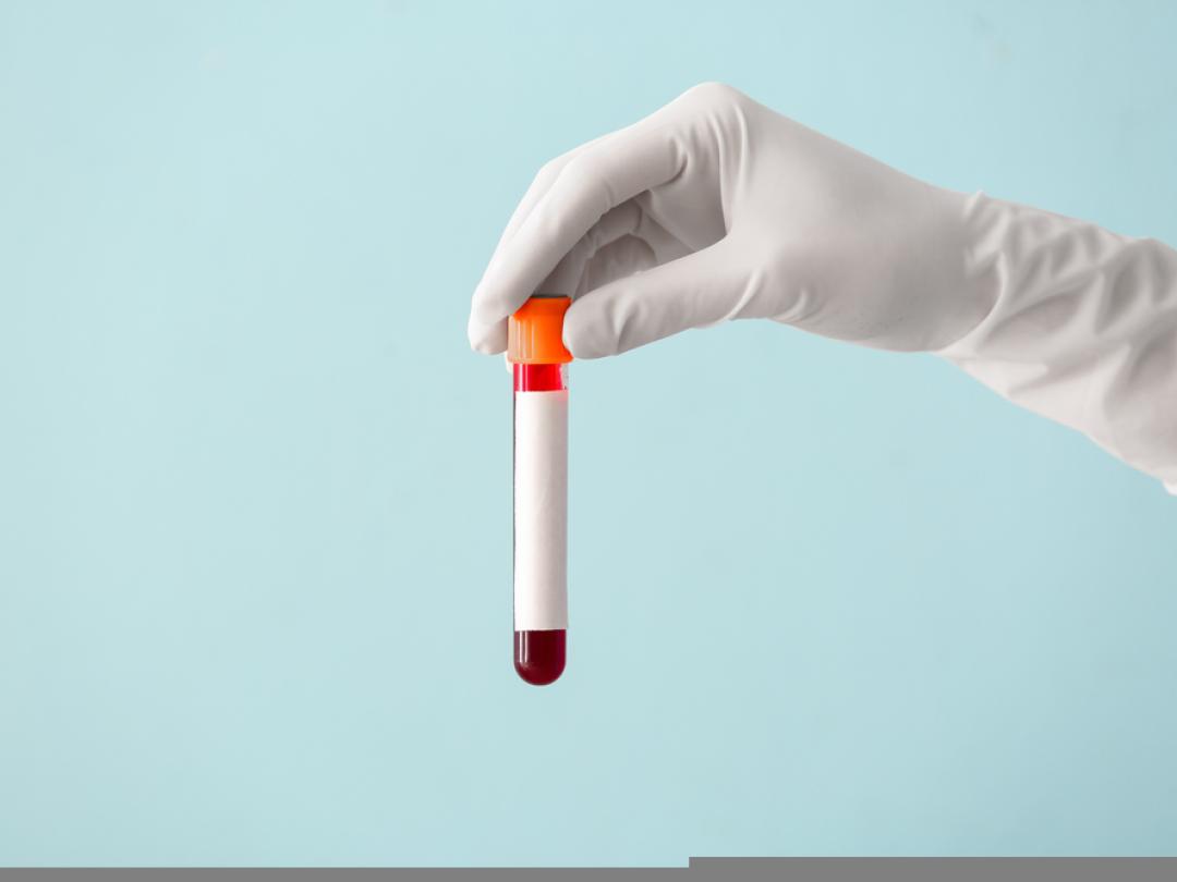 Iemand die een reageerbuis met bloed vasthoudt