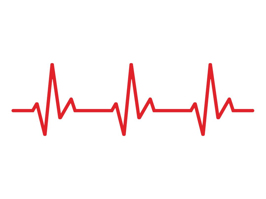 Illustratie van een cardiogram