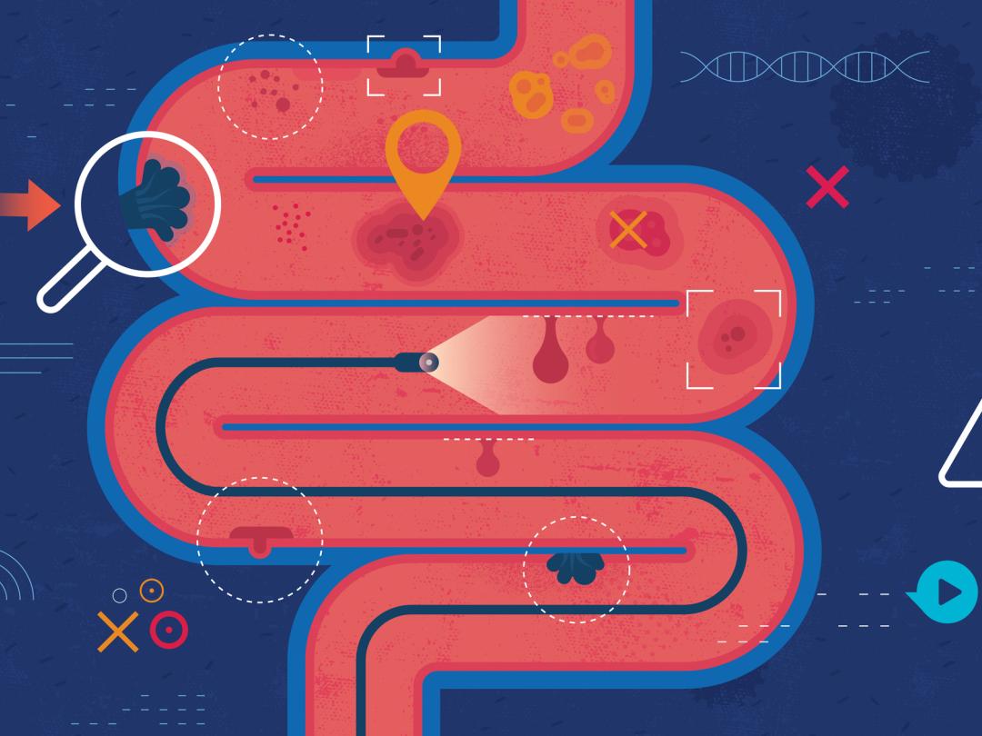 Illustratie van darmen