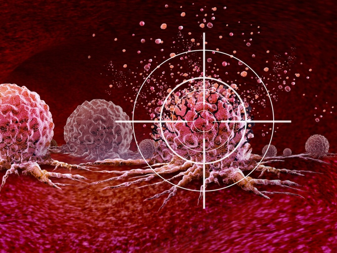 Tumor met een vizier erop gericht