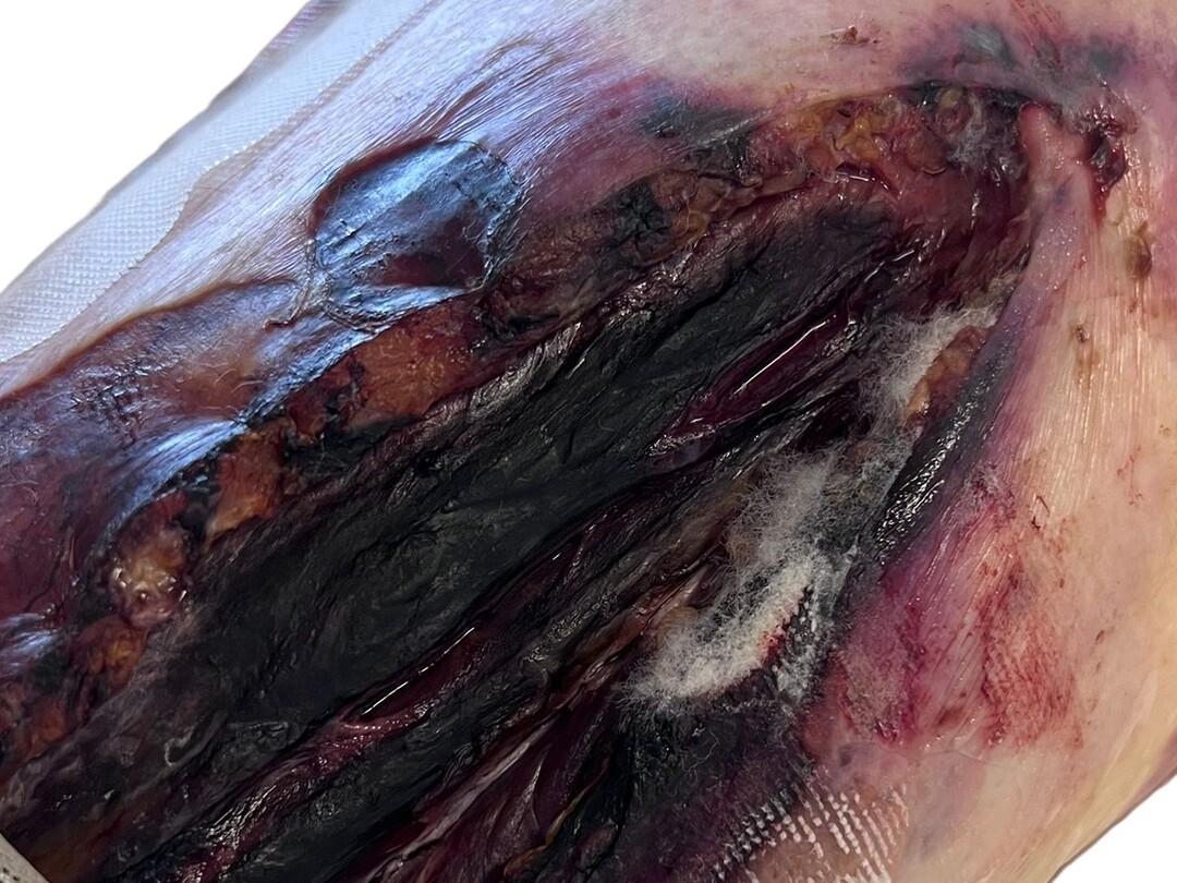 Wond met pluisjes erin