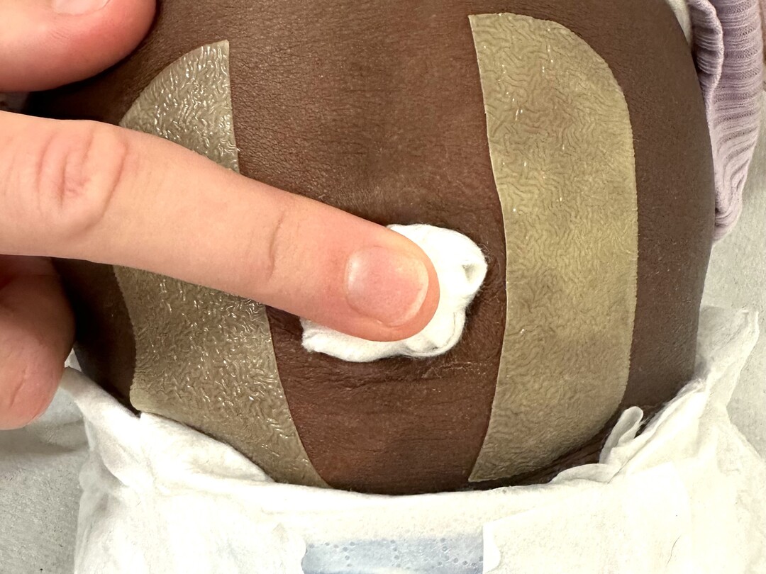 Een afgeplakte navel van baby