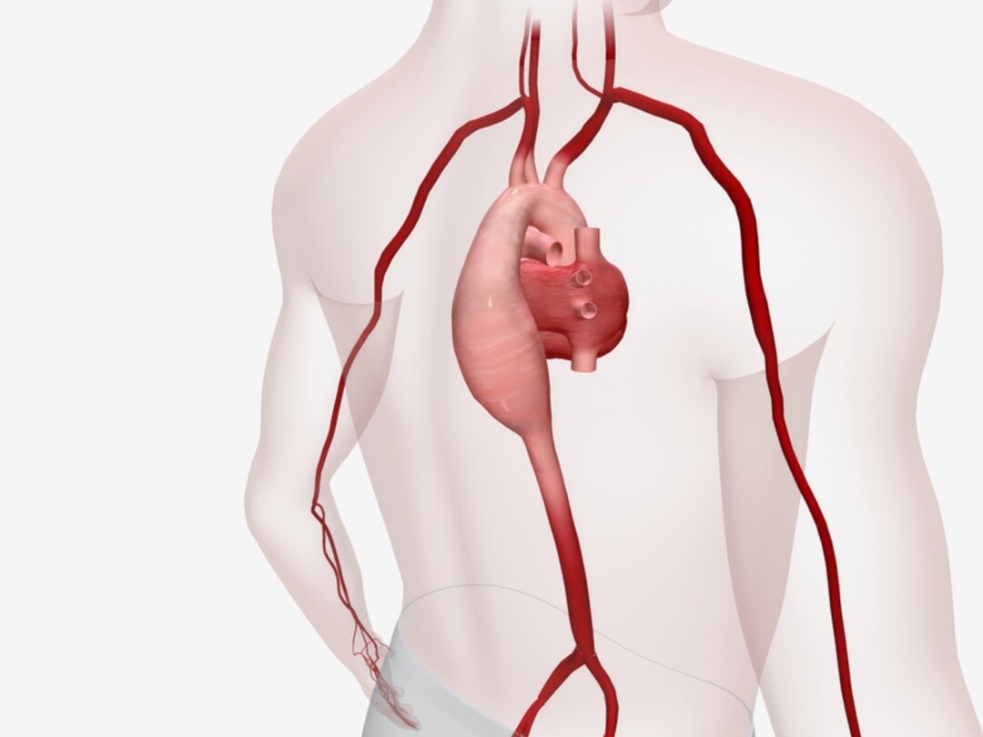 Illustratie van een aorta en hart