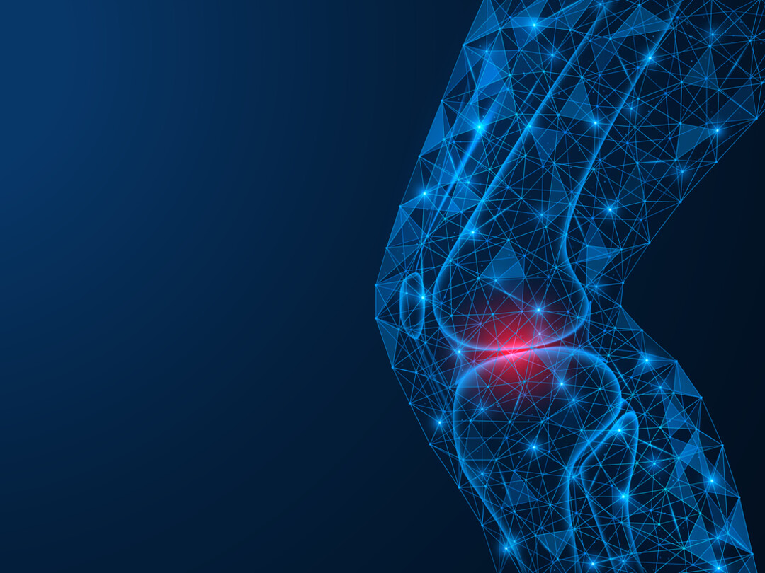 Een knie met artrose