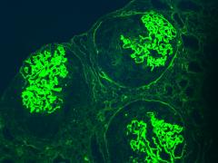 Drie glomeruli zichtbaar in immunofluorescentie-onderzoek.