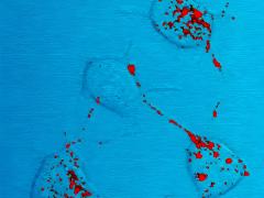 Prionziekten onder de microscoop.