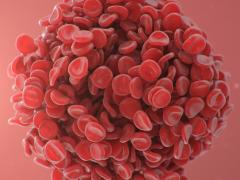 Foto van een microscopische embolie