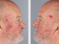 Afbeelding van patiënt