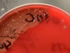 Petri schaal met Kingella kingae
