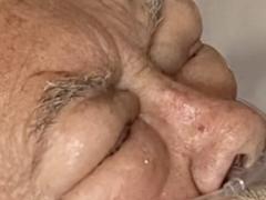 Man met gezwollen ogen