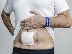 Foto van buik met operatieplijster erop