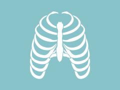 Illustratie van een ribbenkast