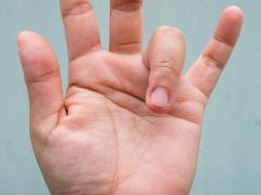 Een hand waarvan de ringvinger gebogen is