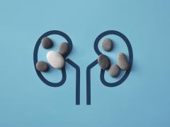 Illustratie van nieren met stenen erin