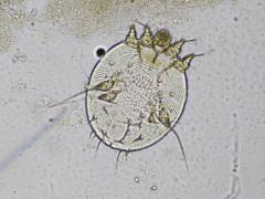 Illustratie van scabiës