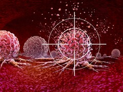 Tumor met een vizier erop gericht