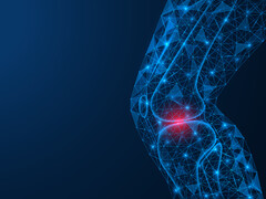 Een knie met artrose